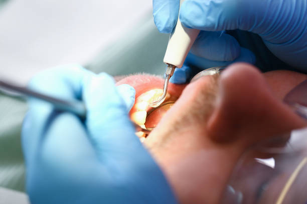 Best Knocked-Out Tooth Emergency  in League City, TX