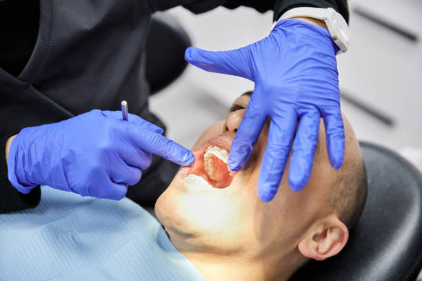 Best Emergency Gum Pain Relief  in League City, TX