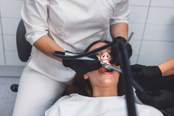 Best Chipped Tooth Repair Near Me  in League City, TX